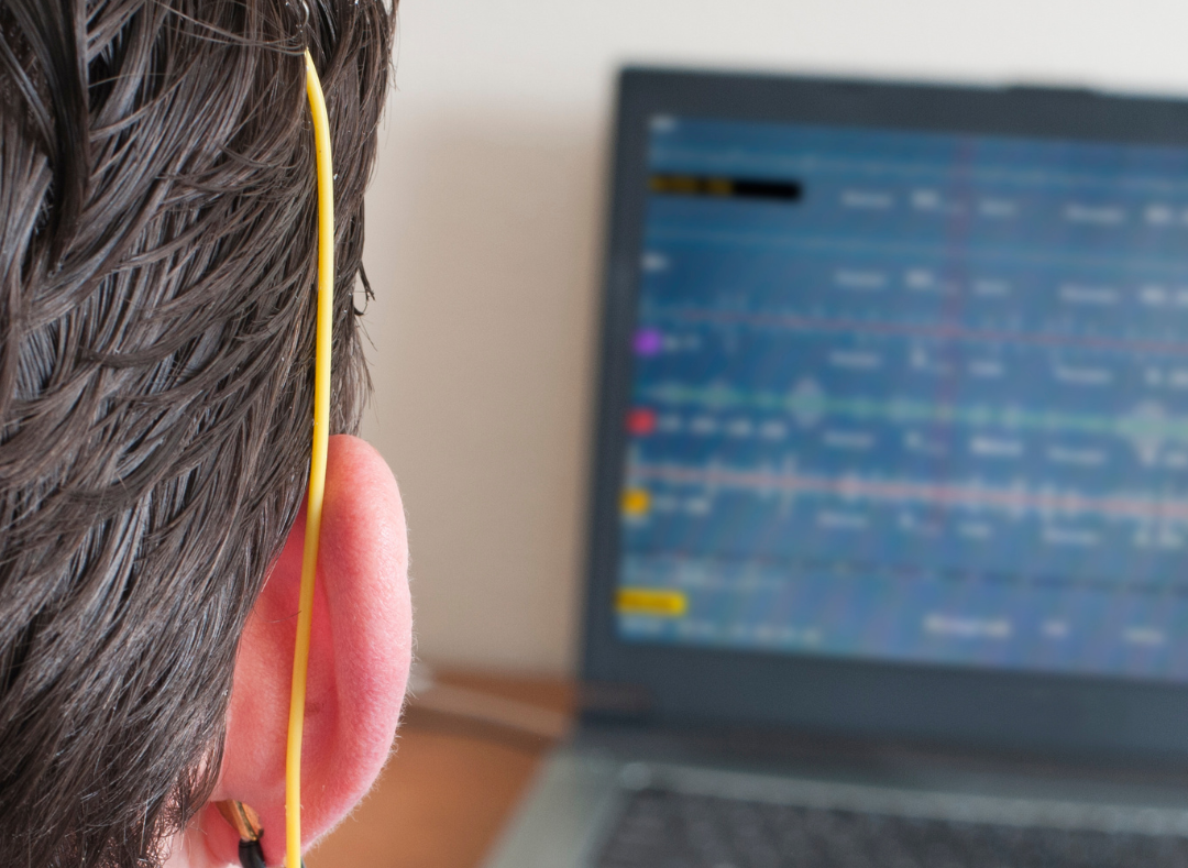 Utilização de tDCS para Melhorar a Atenção em Pacientes com TDAH